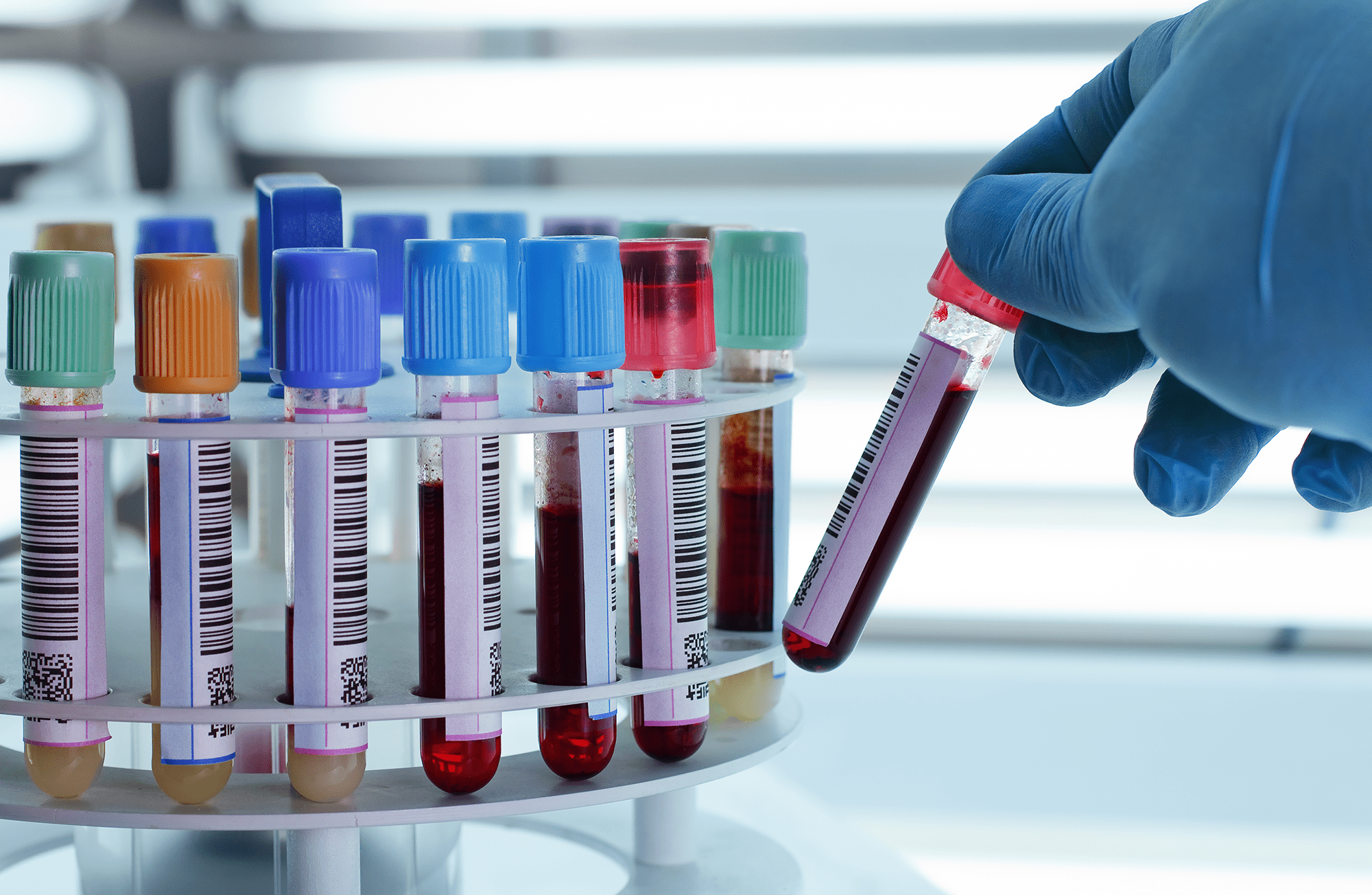 Blood Bank and Laboratory Specimen Labels: Preventing Critical Errors